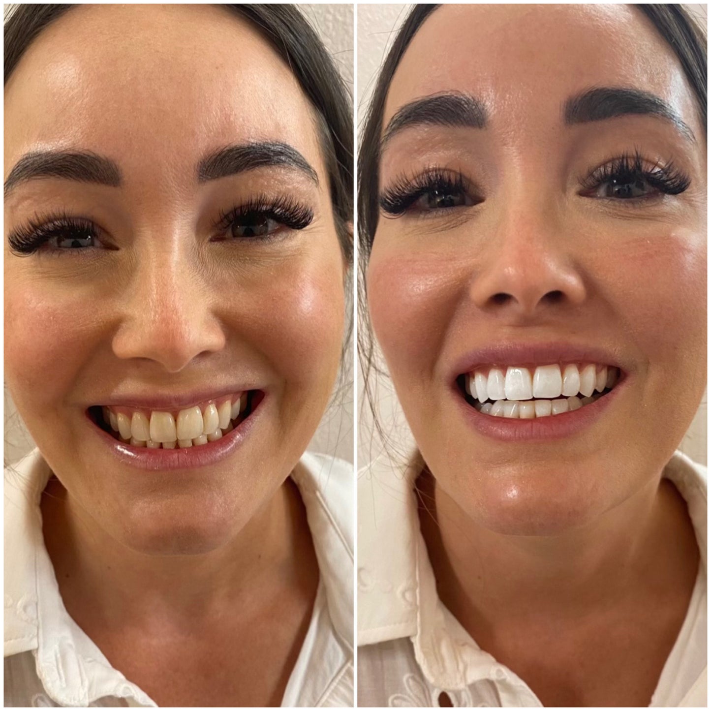 LumaSmile™ Teeth Whitening Powder