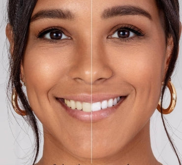 LumaSmile™ Teeth Whitening Powder